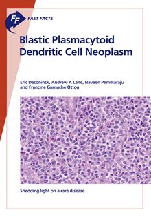 Fast Facts: Blastic Plasmacytoid Dendritic Cell Neoplasm