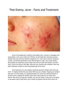 That Enemy, Acne - Facts and Treatment