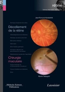 Décollement de la rétine / Chirurgie maculaire (Coll. Coffret rétine, n°6)