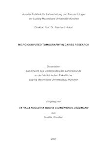 Micro-computed tomography in caries research [Elektronische Ressource] / vorgelegt von Tatiana Nogueira Rocha Clementino Luedemann