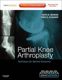 Partial Knee Arthroplasty E-Book