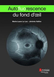 Autofluorescence du fond d œil (Coll. Ophtalmologie)