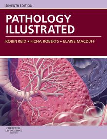 Pathology Illustrated E-Book