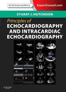Principles of Echocardiography E-Book