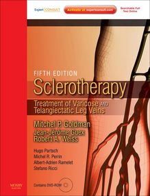 Sclerotherapy E-Book
