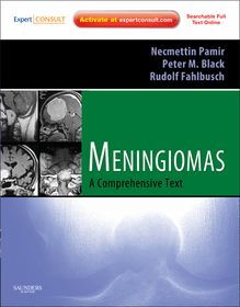 Meningiomas E-Book